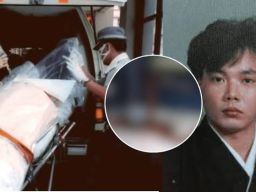 Kisah Tragis Hisashi Ouchi Pria Dengan Kulit Meleleh Menjelang Kematiannya