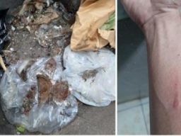 Hampir 4 Tahun, Polsek Lawang Lamban Menangani Laporan Kasus Dugaan Penganiayaan