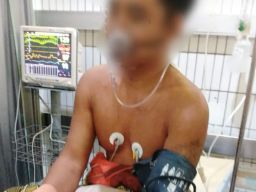 Wartawan Komandopatas Dibacok dan Nyaris Tewas Kena Tembak