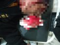 Salah Satu Wartawan Media Online di Majalengka Menjadi Korban Pembacokan