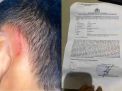 Pelapor Dugaan Penganiayaan Terhadap Anak Anggap Kinerja Polres Lamban