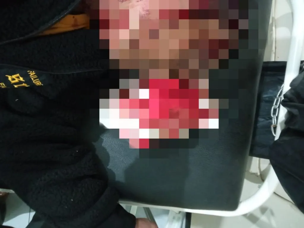 Wartawan Media Online di Majalengka Menjadi Korban Pembacokan