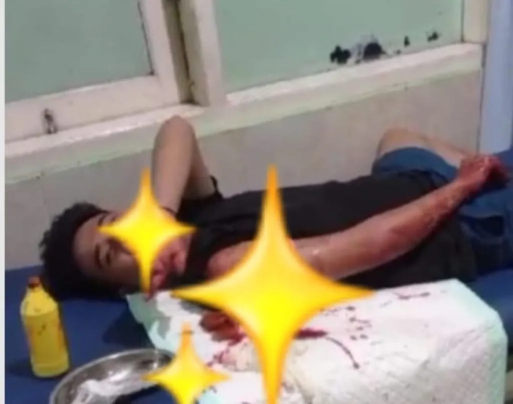 Kawasan Kota Gresik Rawan Pembacokan, Korbannya 2 Orang Remaja