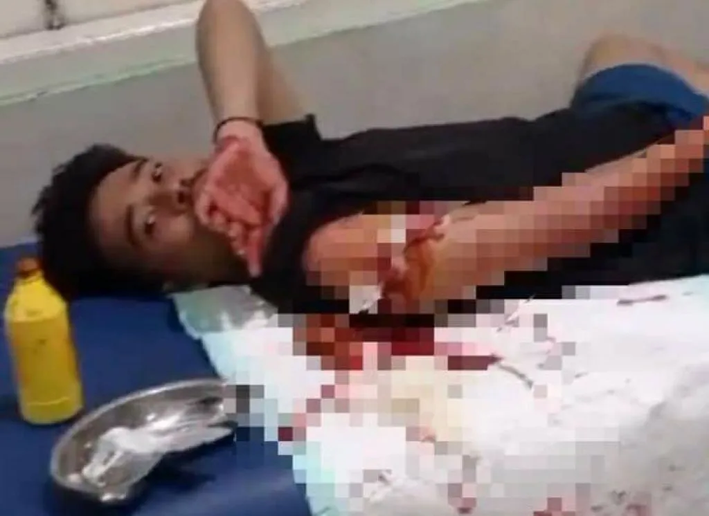 Motif Pelaku Pembacokan 2 Pemuda di Gresik, Dendam ke Pesilat
