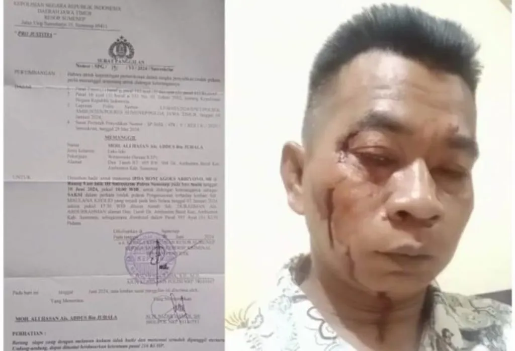 Wartawan Hampir Tewas Jadi Korban Pengeroyokan Malah Mau Jadi Tersangka