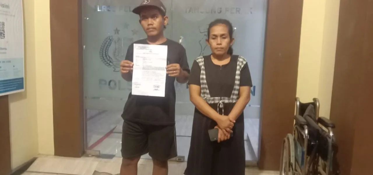Kakinya Dibakar Temannya Saat Tidur, Warga Tambak Wedi Baru Surabaya Lapor ke Polisi