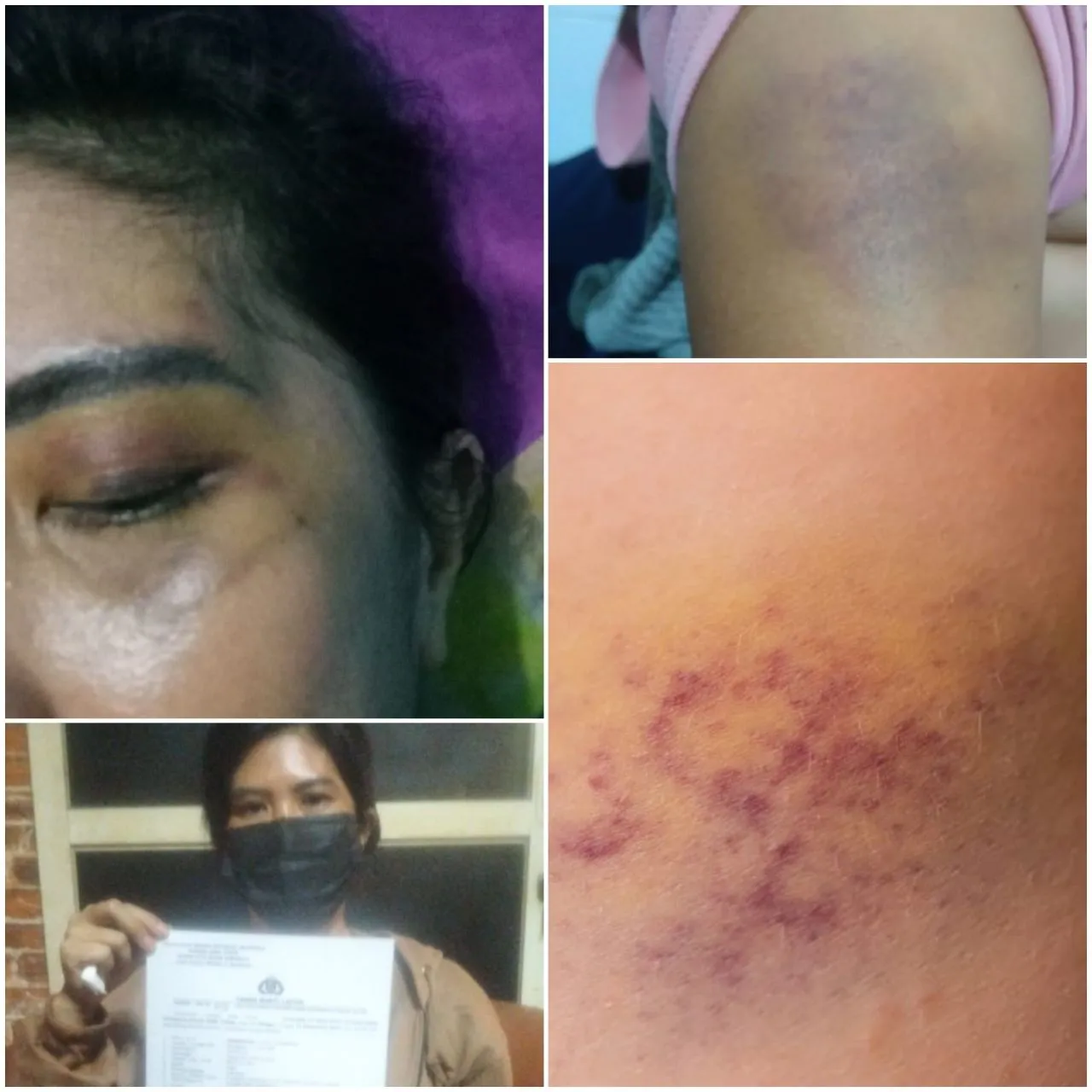 Perempuan di Genteng Surabaya Babak Belur Dianiaya Pacar