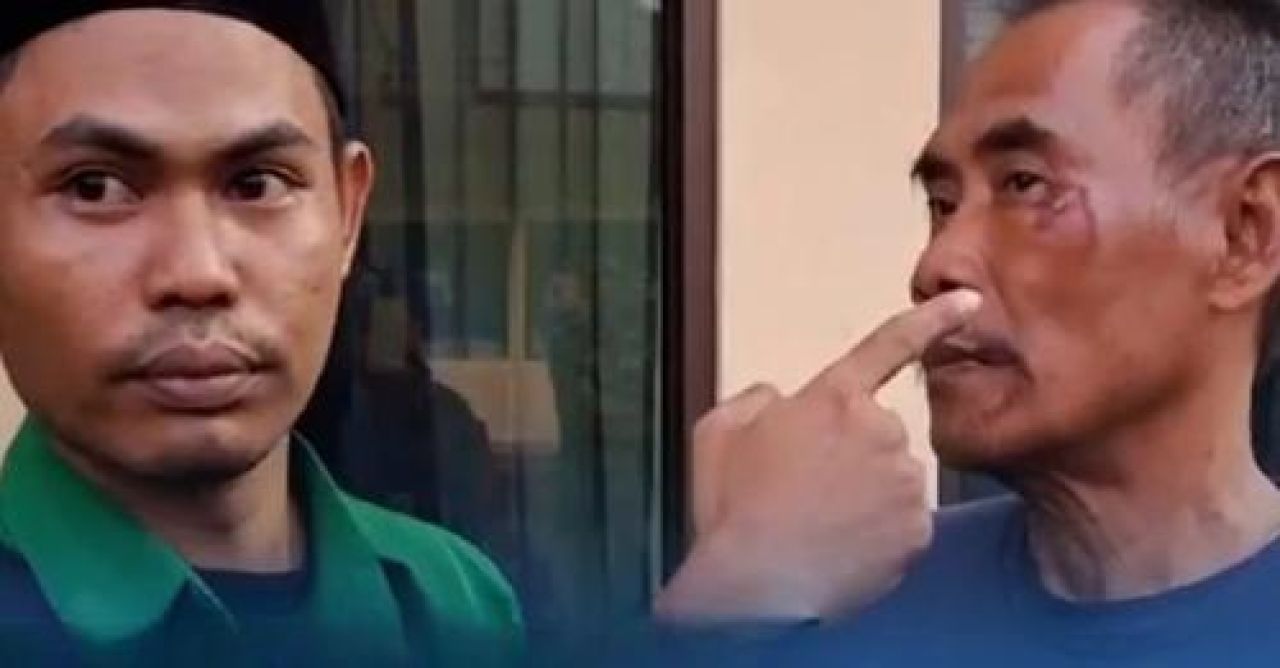 Wajah Juariyanto mengalami luka