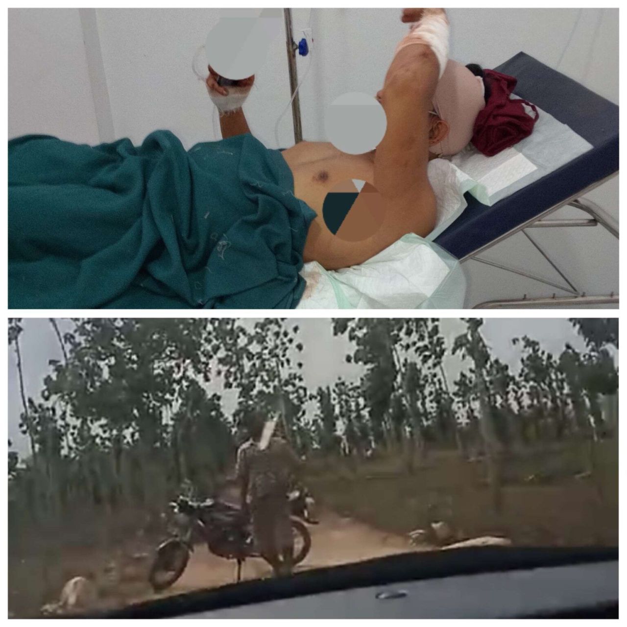 Korban pembacokan (foto atas). Foto bawah : salah satu terduga pelaku