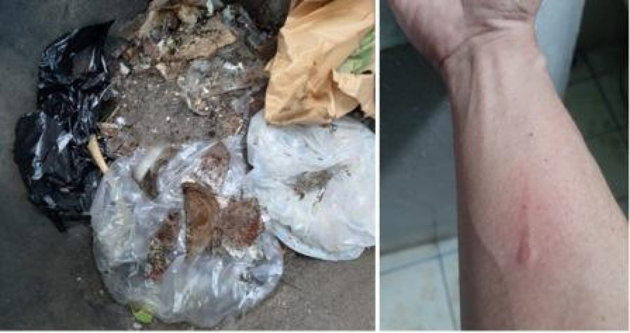 Bekas luka di tangan kaki dan barang bukti