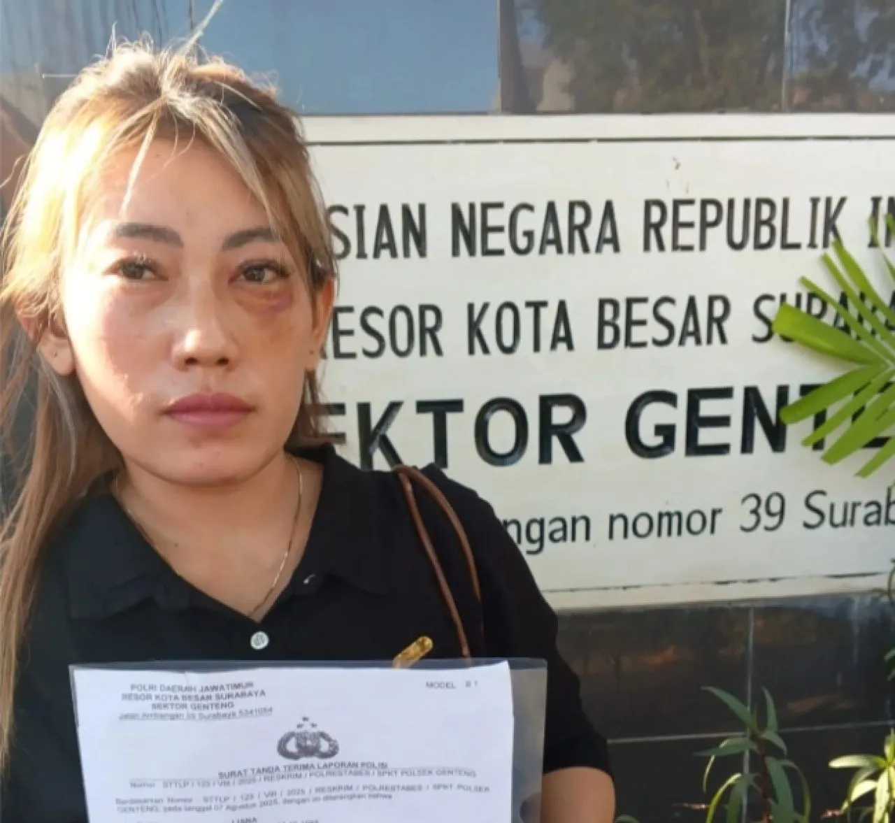 Kasus Penganiayaan di SO Kayoon Surabaya Naik ke Penyidikan