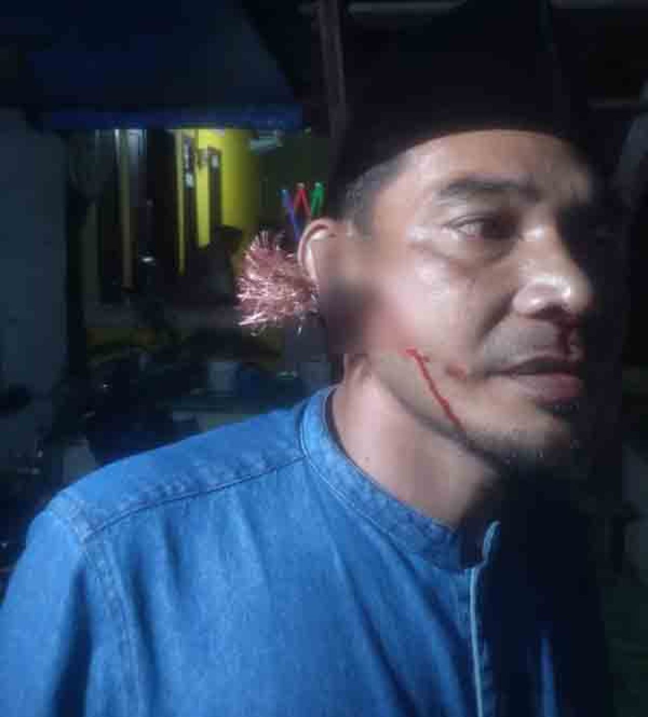 Kepala Dusun yang pipinya kena busur
