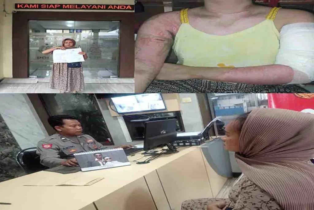 Korban Penganiayaan Kecewa, Laporannya di Polsek Kenjeran Lamban