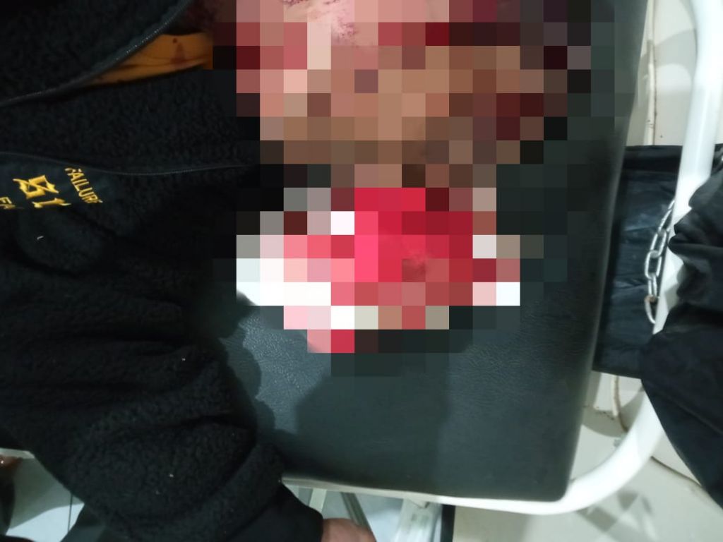 Johan saat ditangani perawat Puskesmas Malausma