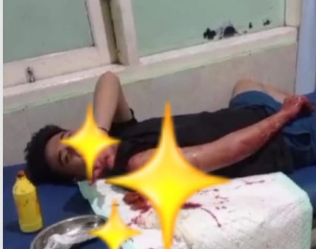 Salah satu korban pembacokan